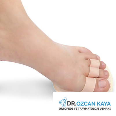 Ayak Ayak Bile i Hastal klar Cerrahisi Do Dr zcan Kaya 0530 257 Ayak Ayak Bile i Hastal klar Cerrahisi Do Dr zcan Kaya 0530 257