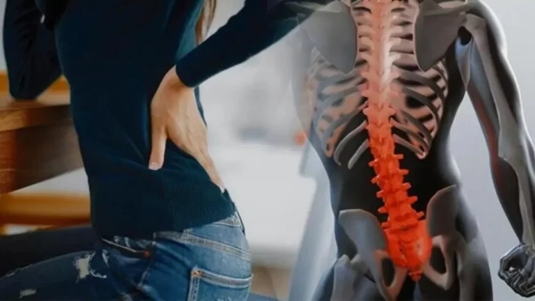 Bel ağrısı ve Lomber Dar Kanal Tedavisi