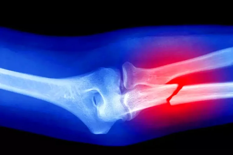 Robotik Cerrahi ile Kompleks Kırık Onarımları: Avantajlar ve Riskler
