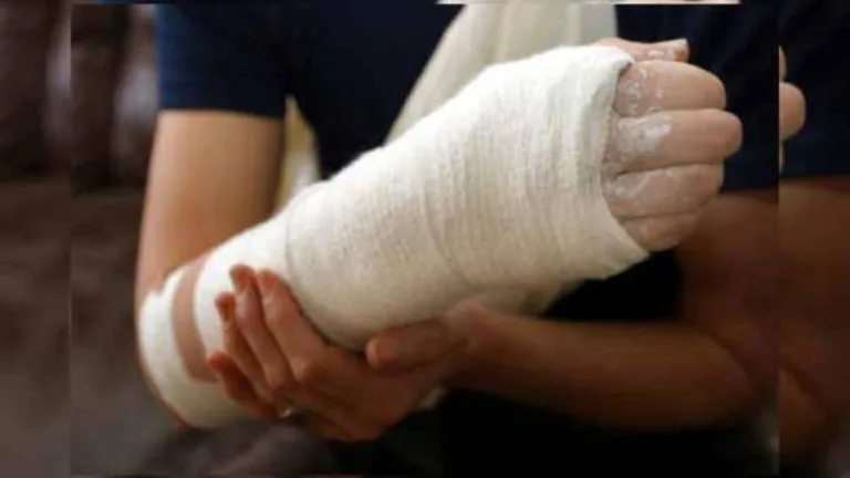 Kırık Sonrası Şişlik ve Morluk Ne Zaman Tehlikelidir?