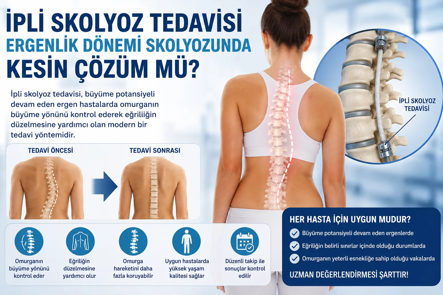 İpli Skolyoz Tedavisi