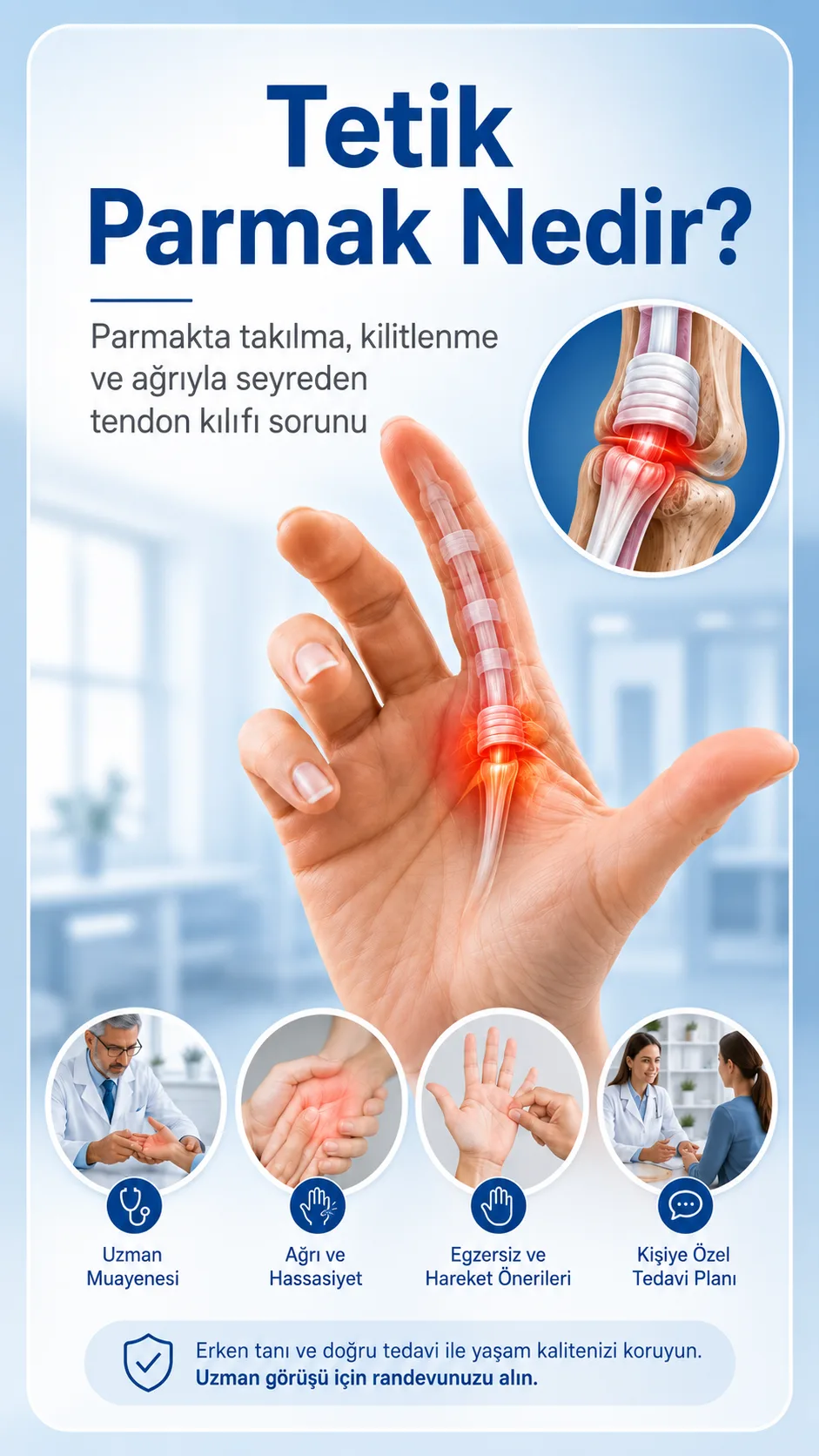 Tetik Parmak