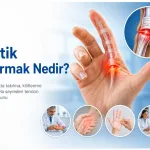 Tetik Parmak Nedir?
