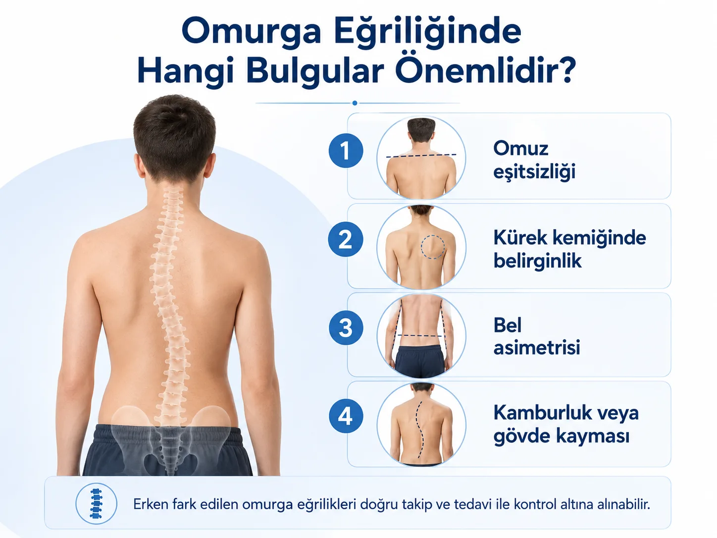 Omurga Eğriliği
