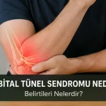 Kubital Tünel Sendromu Nedir? Belirtileri Nelerdir?