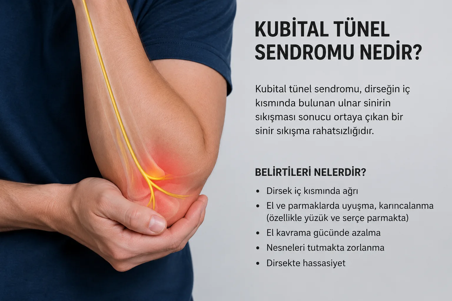 Kubital Tünel Sendromu 